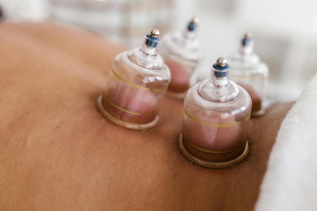 Cupping Therapy at Home: What You Need to&nbsp;Know